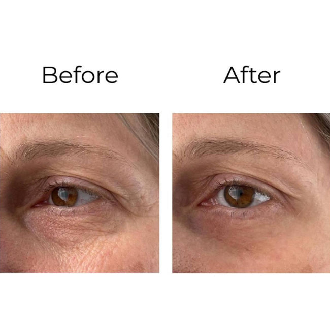 Anti-Falten-Augencreme „Shock Action & Quot“-Effekt mit Liphasyn™